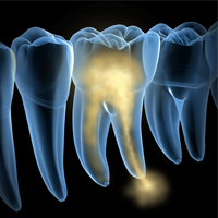 دوره های دندانی