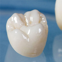 پرکردگی سرامیکی دندان