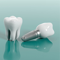 بهترین ایمپلنت های دندانی کدامند؟